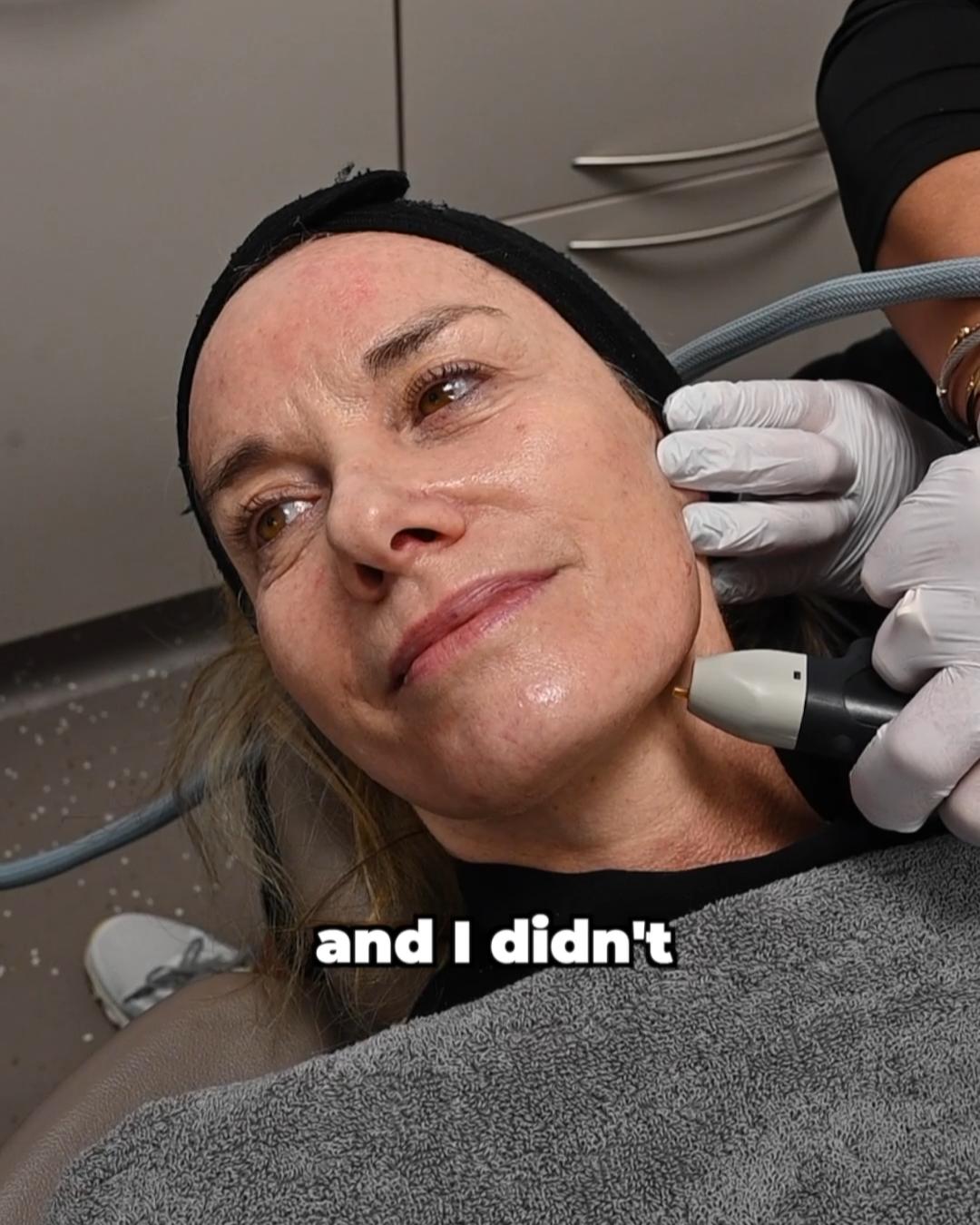 Tamzin Outhwaite — NeoGen™ plasma skin treatment results